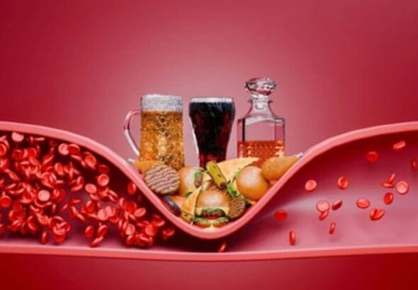 la-diabetes-y-el-colesterol-alto-disparan-hasta-seis-veces-el-riesgo-de-alzheimer-y-parkinson-un-llamado-urgente-a-la-prevencin