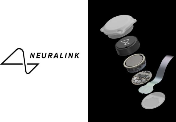 elon-musk-y-neuralink-el-chip-blindsight-que-podra-devolver-la-vista-a-personas-ciegas